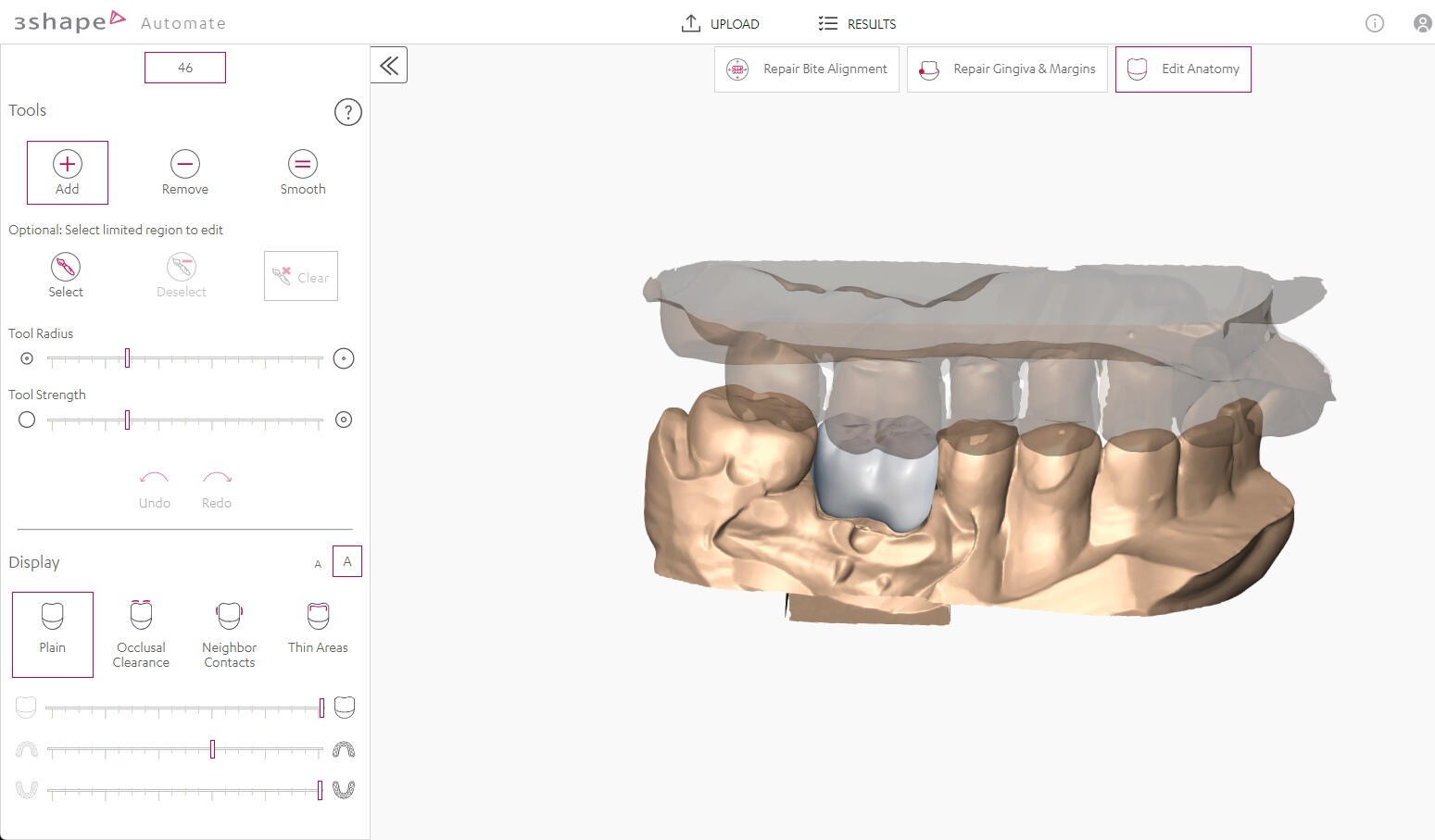 Clean modern dental lab interior at Rutherford Dental Lab in Livermore CA showing precision milling equipment and CAD CAM workflow for R.I.S.E. crown program